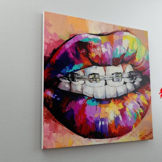 Brackets - Canvas Mérida Fine Print Art