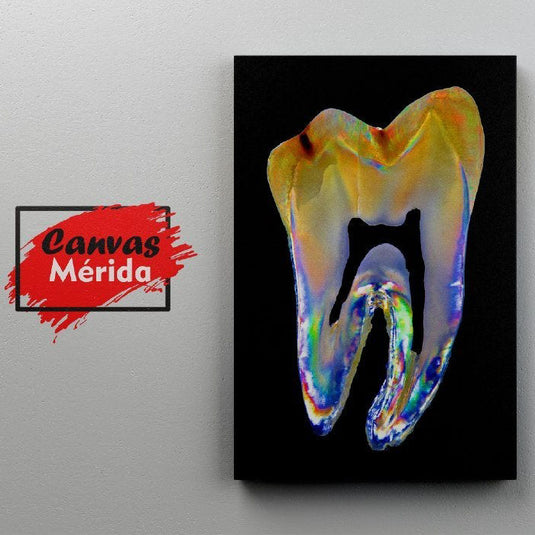 Radiografía artística de molar humano con paleta de colores iridiscentes