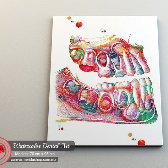 Watercolor Dental Art - Canvas Mérida Fine Print Art